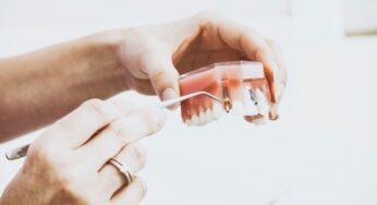 Dental Implants Kelowna: Advantages, Procedure, and Post-Procedure Care